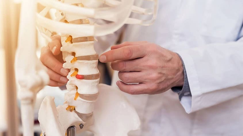 Chiropractor pointing at a herniated disc on a spinal model